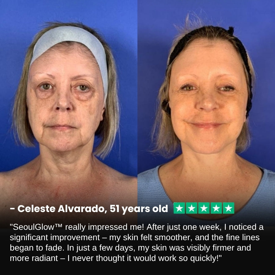SeoulGlow™ |  4% Retinal Liposome Facial Treatment