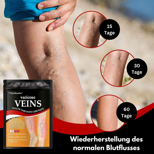 ™VeinSoothe | הכניעו את כאבי הוורידים הכרוניים!