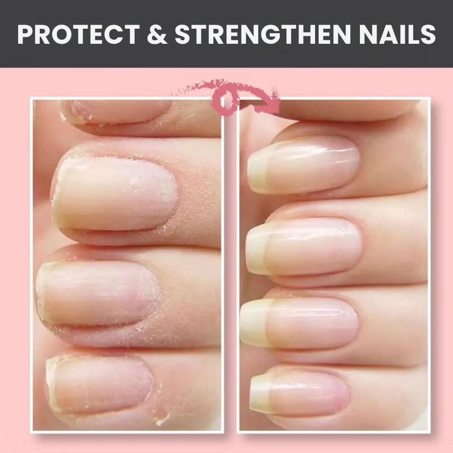 EverNail™ | Nail Repair Protection Gel