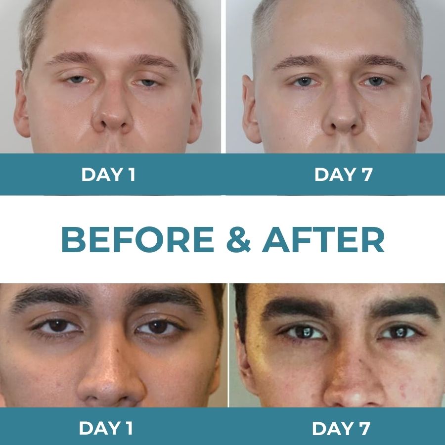 LidEyex™ | Retina Ester Elastic Moisturising Eye Cream