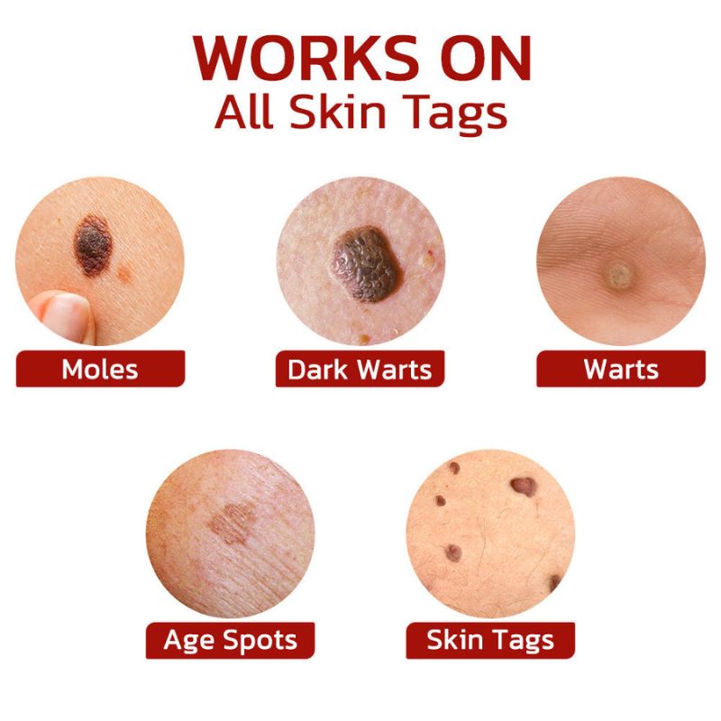 DermaFix™ | Tags & Moles Remover Serum Pen