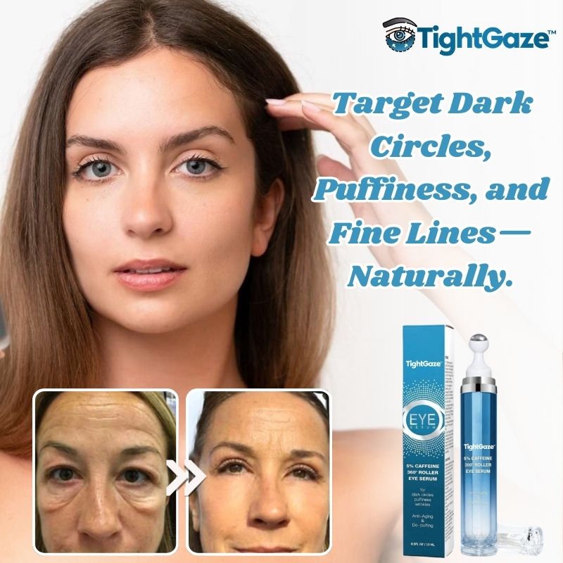 TightGaze™ | Under-Eye Rolling Cream