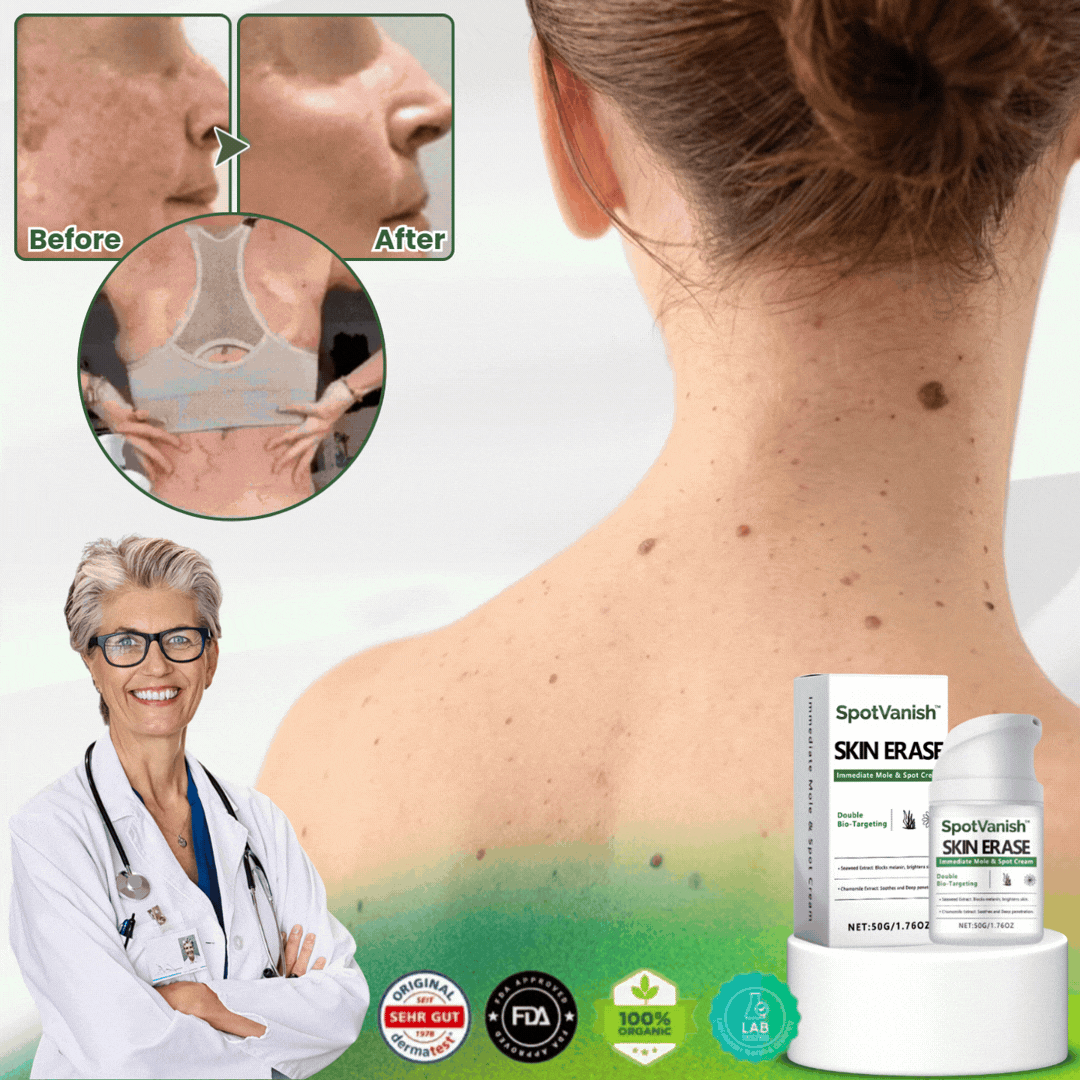 SpotVanish™ | Immediate Mole & Spot Cream