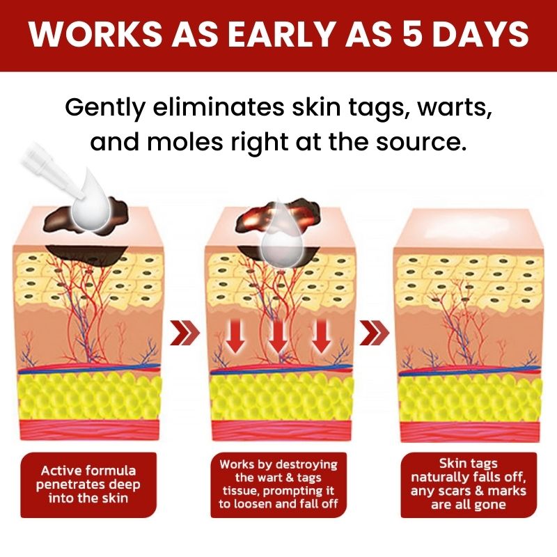 DermaFix™ | Tags & Moles Remover Serum Pen