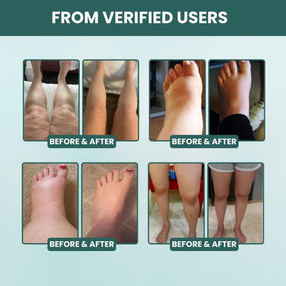 LymphLight™ | Natural Lymphatic Support Softgels