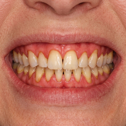 Biomevia™ | Oral Defence Chews