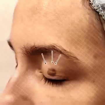 HautKlar™ | היפטר מיבלות עור מעצבנות תוך 7 ימים בלבד!