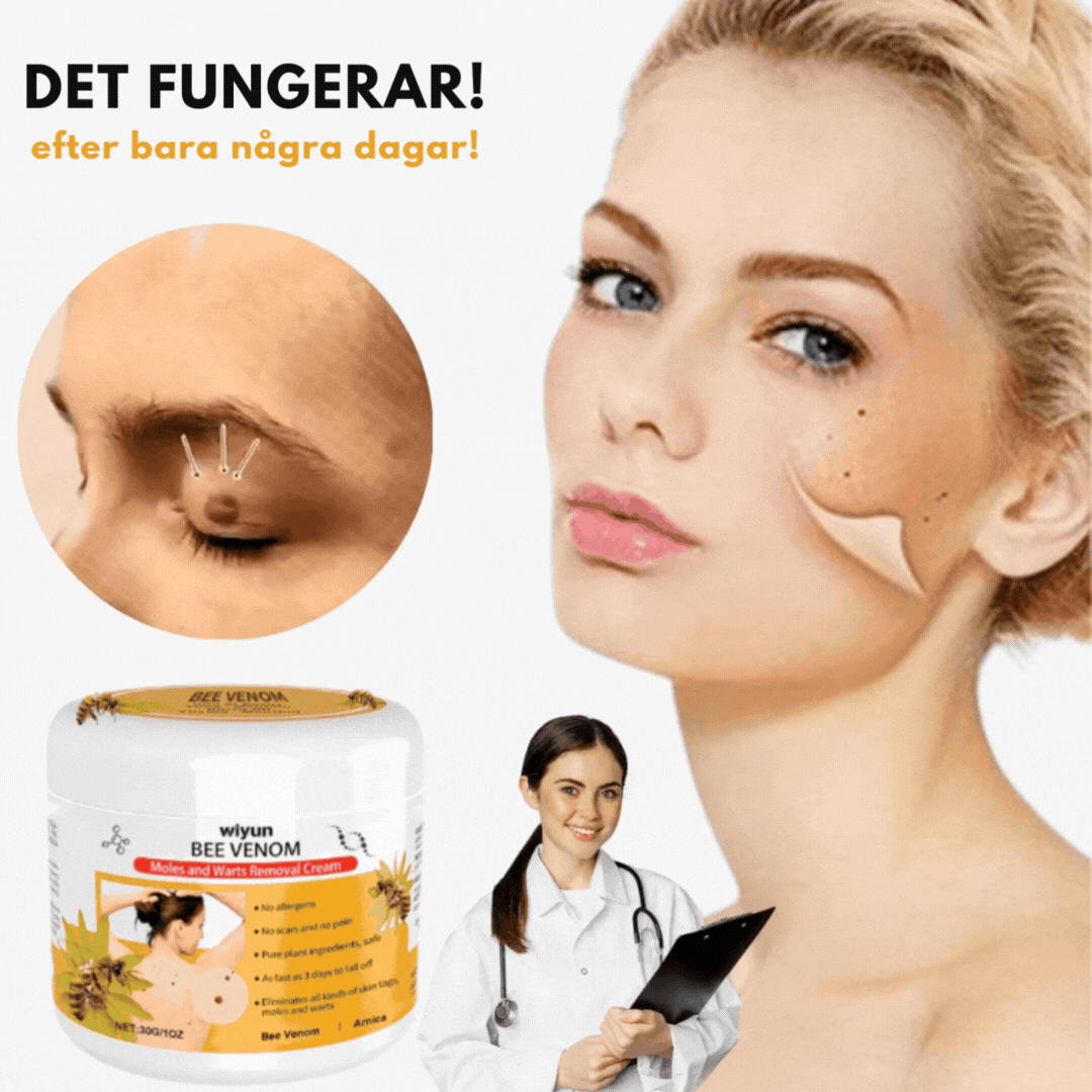 HudKlar™ | Bli av med irriterande hudvårtor på bara 7 Dagar!