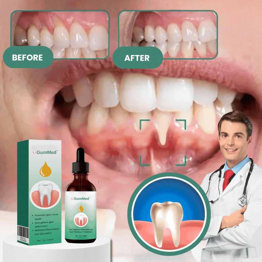 GumMed™ | Gum Restoration Drops