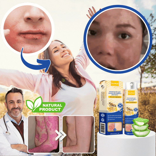 PsoriHeal™ | Psoriasis and Eczema Treatment Spray