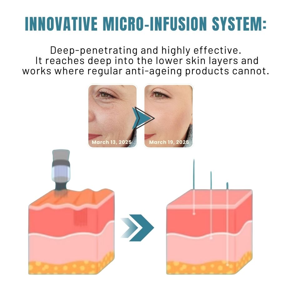 RevitaPen™ | Microinfusion Pen System