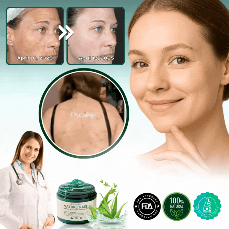 PerfectSkin™ | Instant Mole & Spot Removal Gel