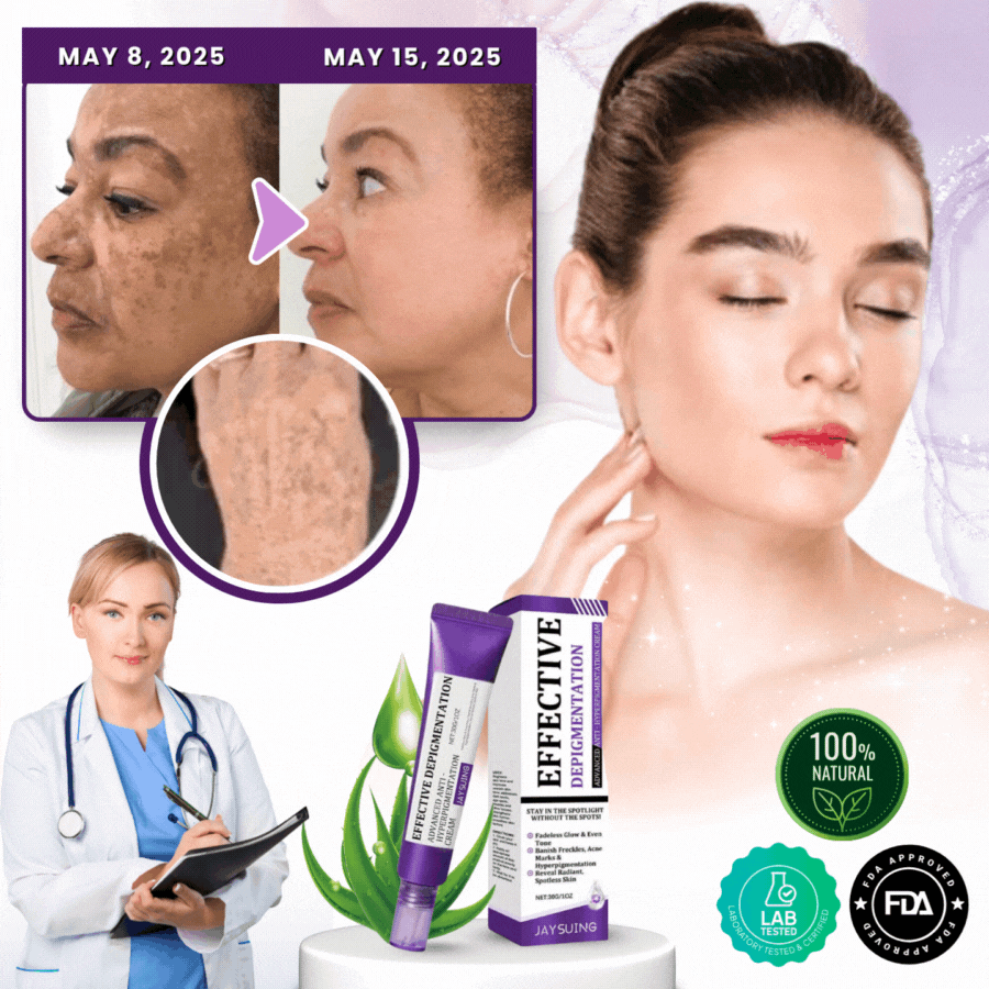 BrillaSkin™ | Advanced Anti-Hyperpigmentation Cream