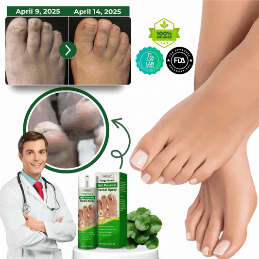 NailHeal™ | Herbal Nail Renewal Spray