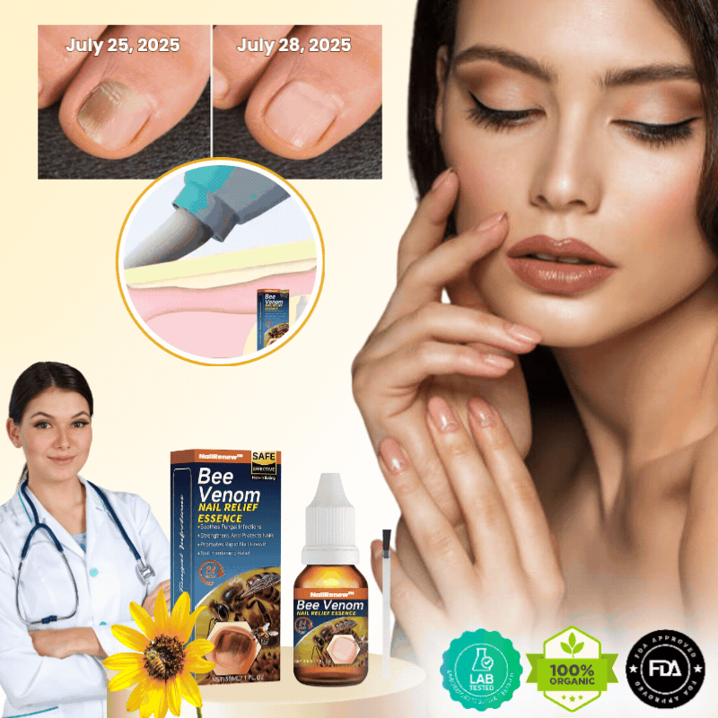 NailRenew™ | Antifungal Nail Renewal Oil