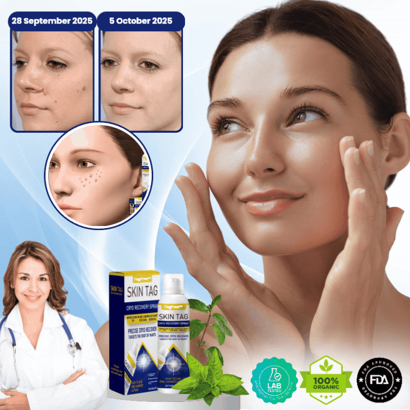TagFree™ | Cryotherapy Skin Tag Remover Spray