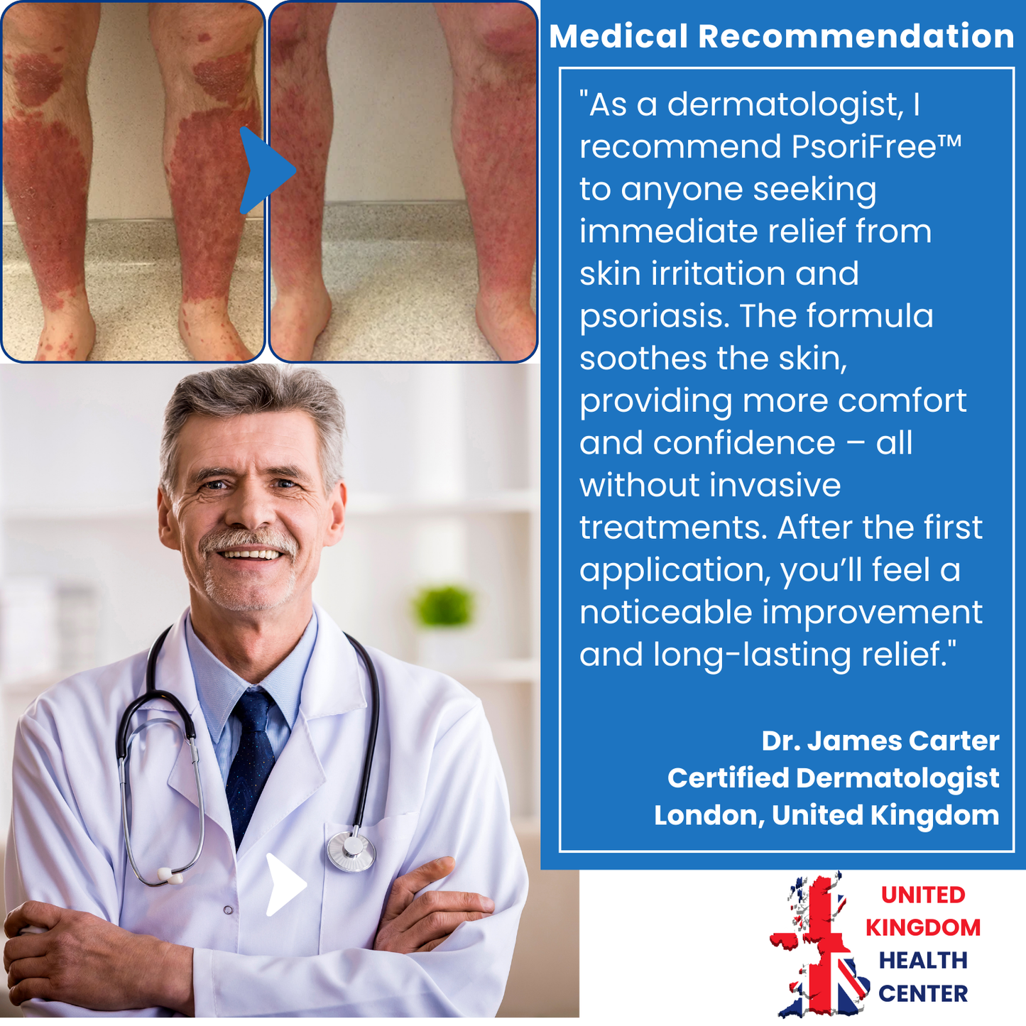 PsoriFree™ | End Redness and Flaking in 5 Days!