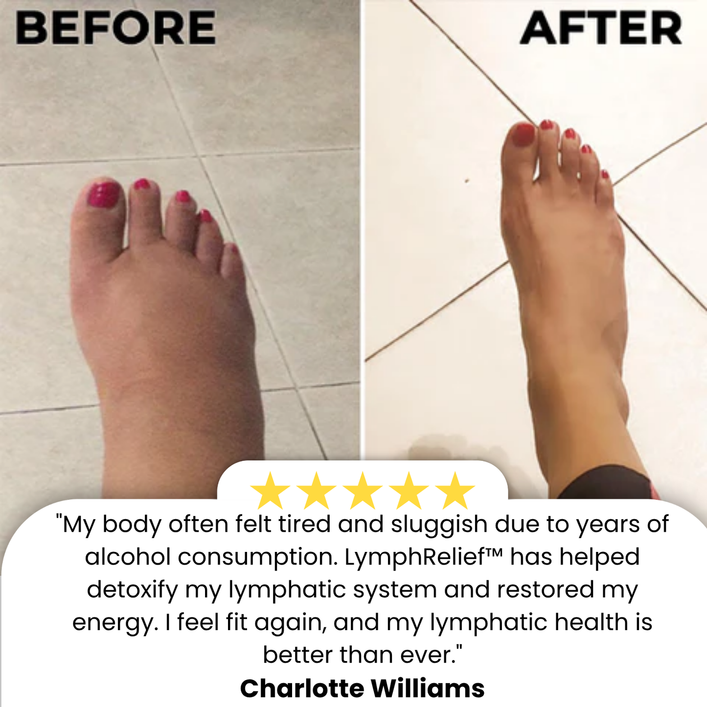 LymphRelief™ | Relieve Swelling in Just 15 Minutes!