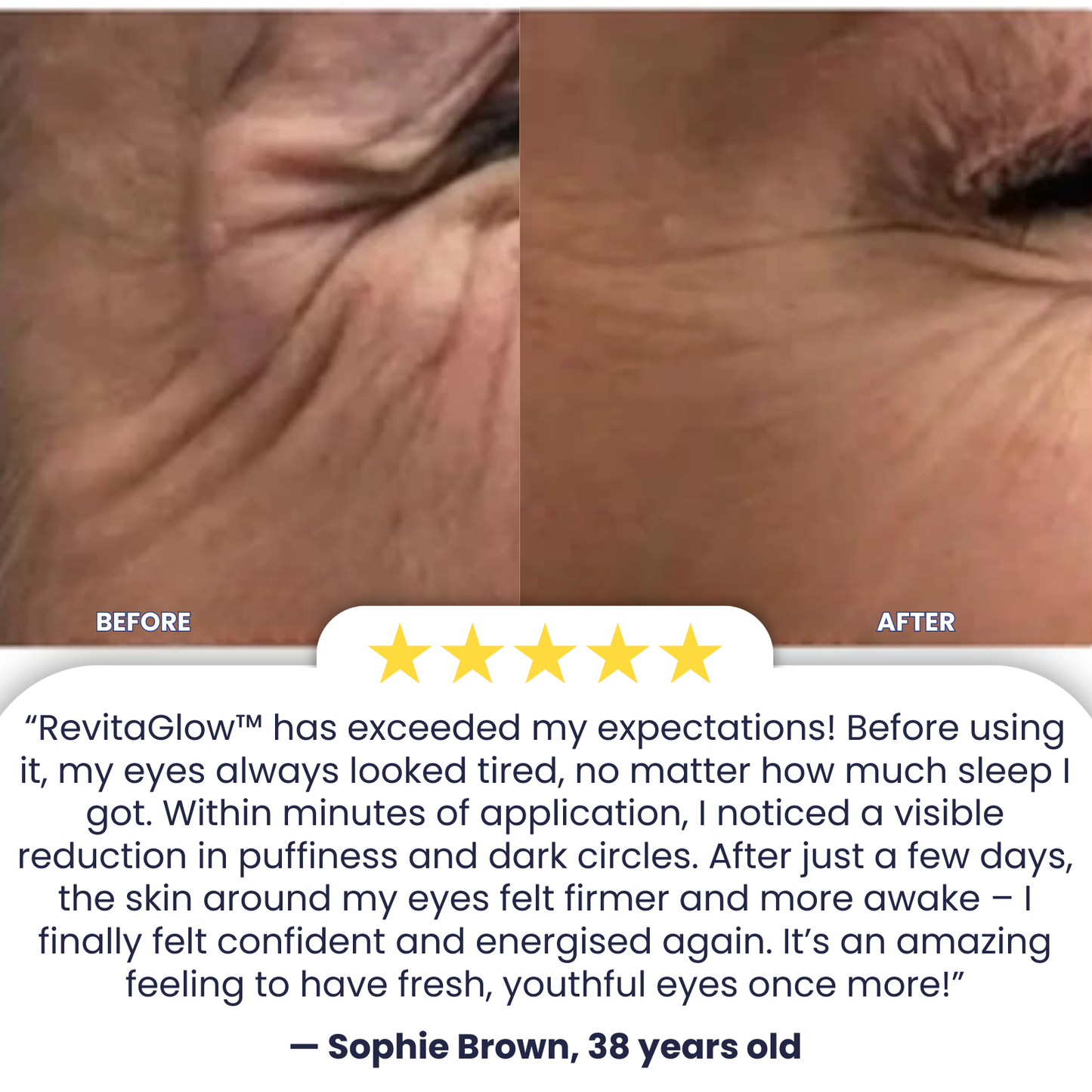 RevitaGlow™ | Erase 95% of Wrinkles, Lift Your Eyes!
