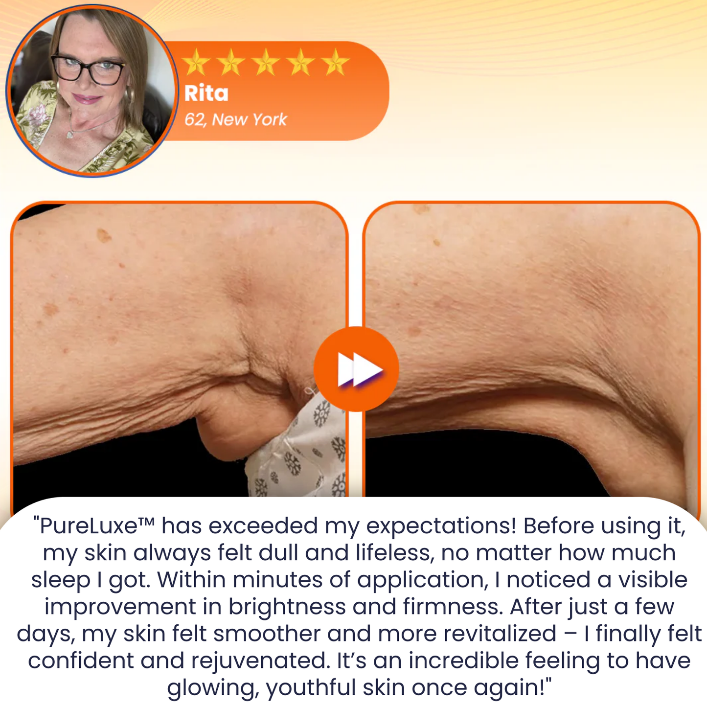 PureLuxe™ | 95% Skin Improvement – Instantly Erase Dull