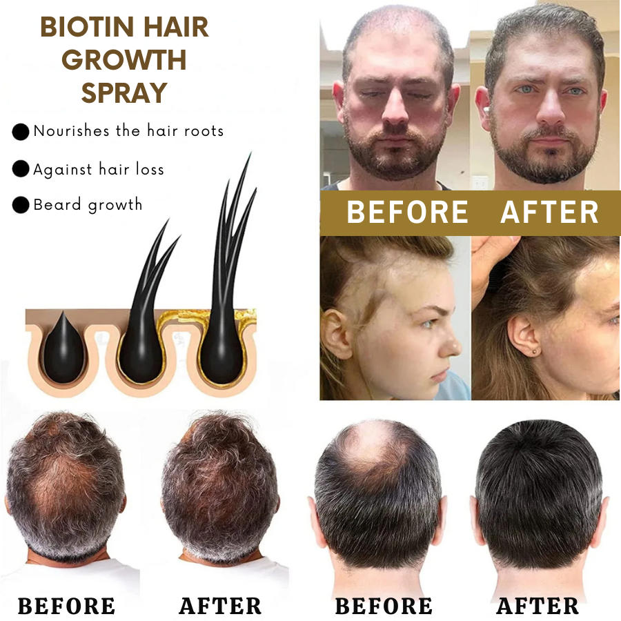 VitaGrow™ Spray | Stop hair loss and Regrow up to 99%!