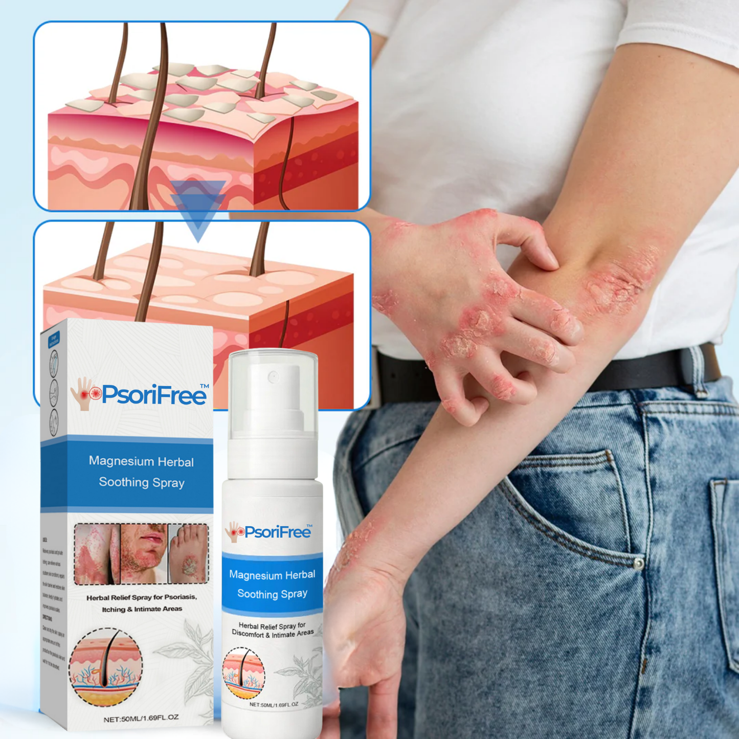 PsoriFree™ | End Redness and Flaking in 5 Days!