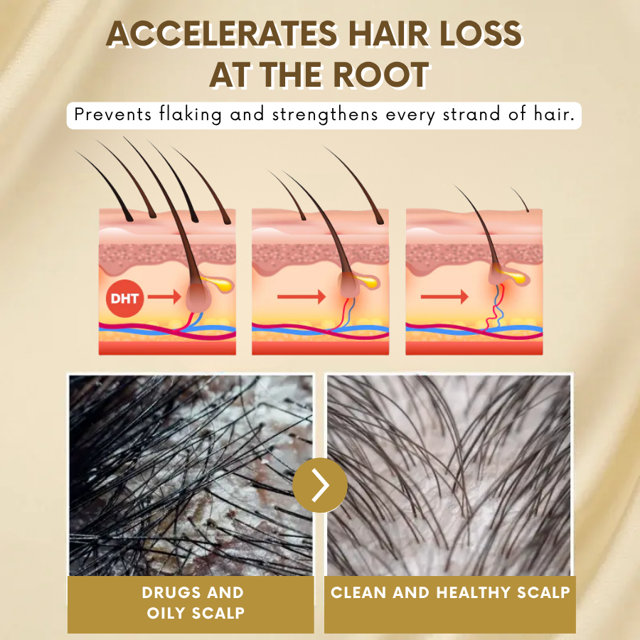 VitaGrow™ Spray | Stop hair loss and Regrow up to 99%!