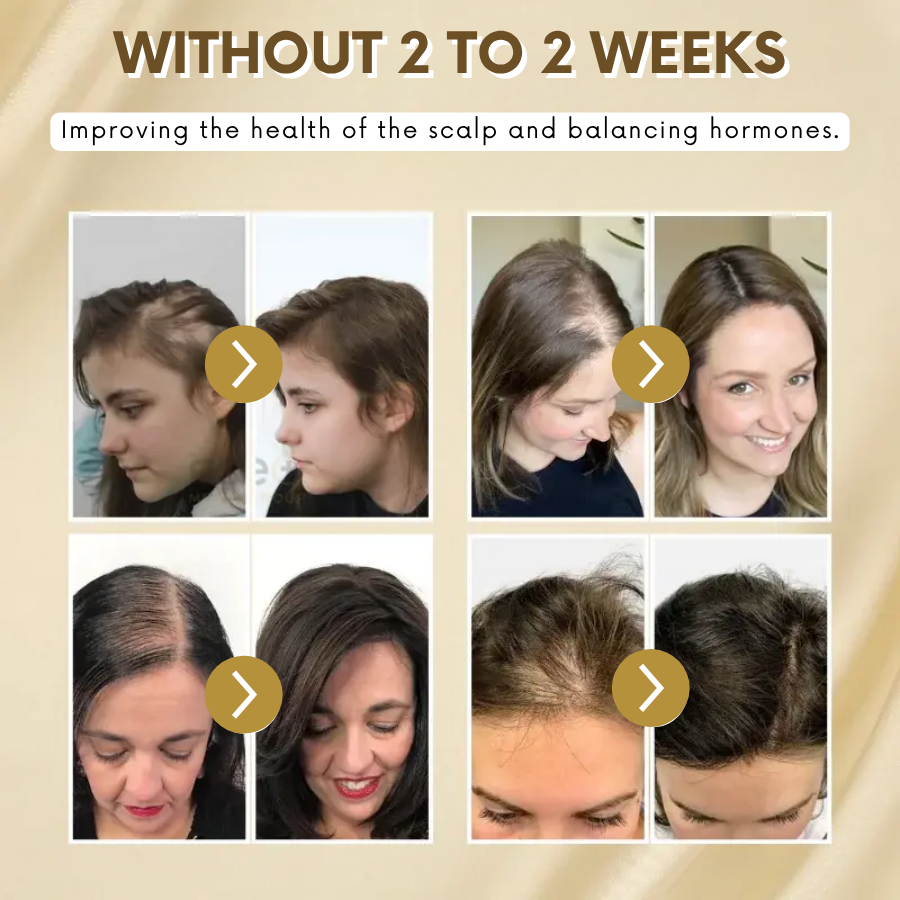 VitaGrow™ Spray | Stop hair loss and Regrow up to 99%!