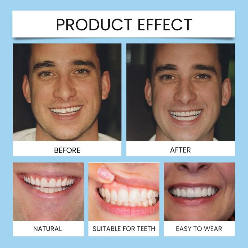 GrinEase™ | Get a Radiant Smile in Just 3 Minutes!