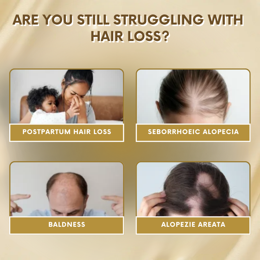 VitaGrow™ Spray | Stop hair loss and Regrow up to 99%!