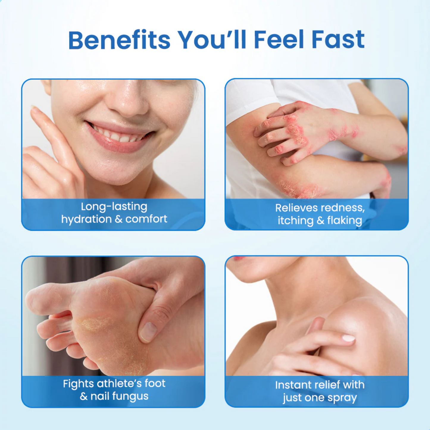 PsoriFree™ | End Redness and Flaking in 5 Days!