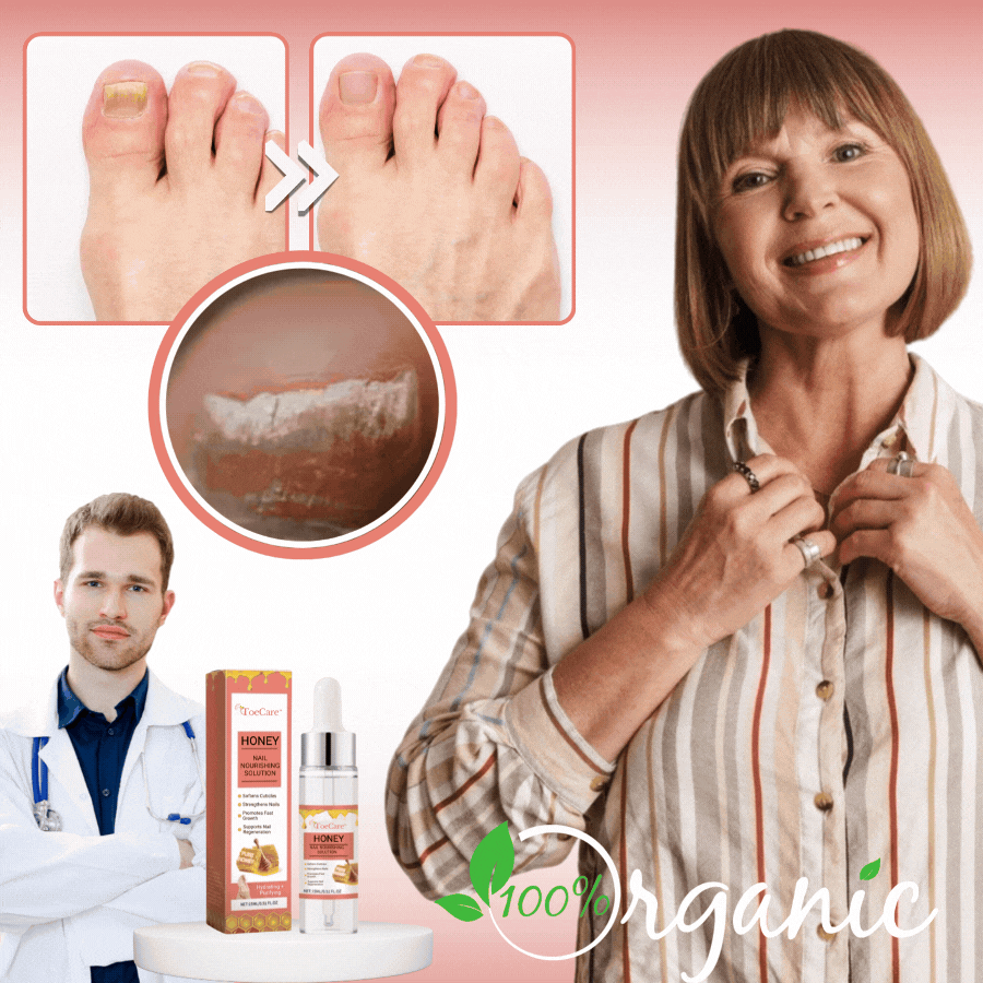 ToeCare™ | Nail Fungal Treatment Drop